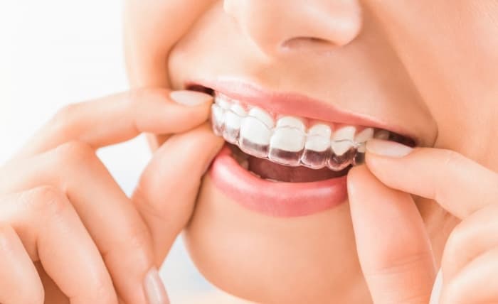 Do I need orthodontics or teeth braces? 3 points to check