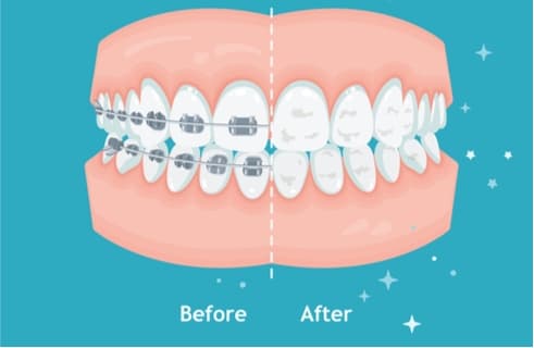 Rescue White Spotted Teeth