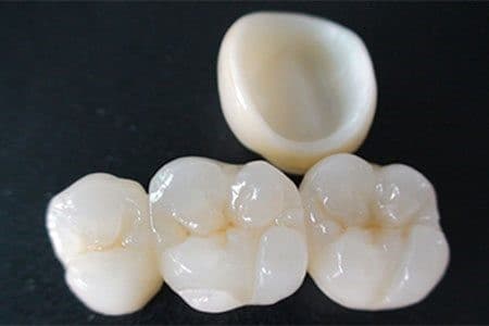 全鋯冠