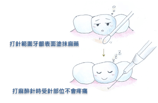 杜牙根麻醉