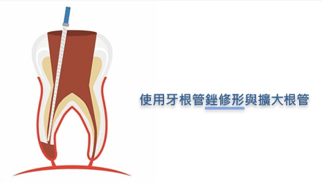 杜牙根