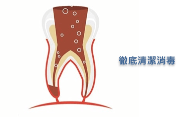 杜牙根沖洗