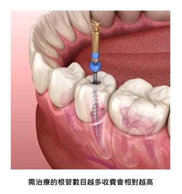 杜牙根價格
