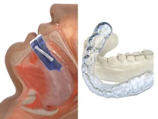 CPAP Machine vs. Customized Dental Sleep Apnea Device：How to Choose the Most Suitable Solution?