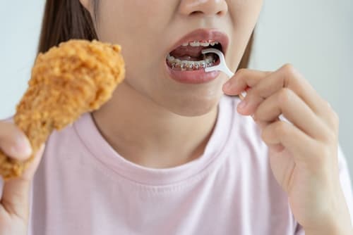  正在箍牙的女性進食炸雞，示範戴牙箍期間應注意的飲食問題。