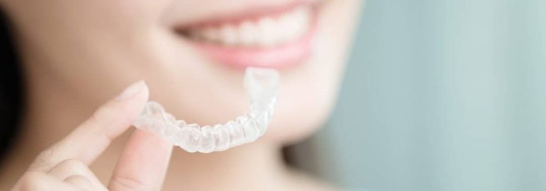 矯正牙齒(箍牙)新選擇:使用隱形牙套隱適美 (Invisalign)前必須知道的基本知識及流程