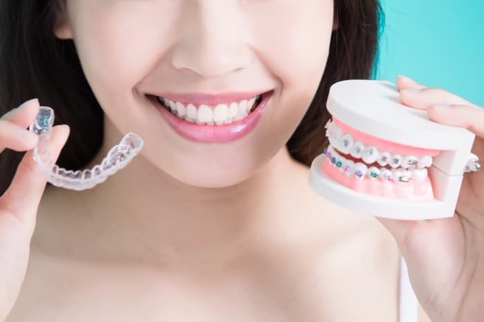 Invisalign Hong Kong