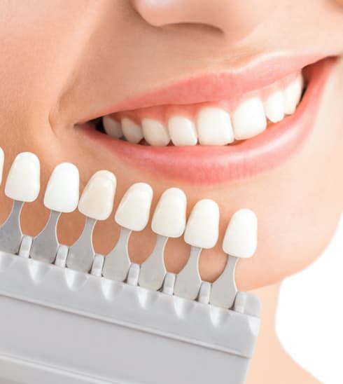 重視質素 後續保養