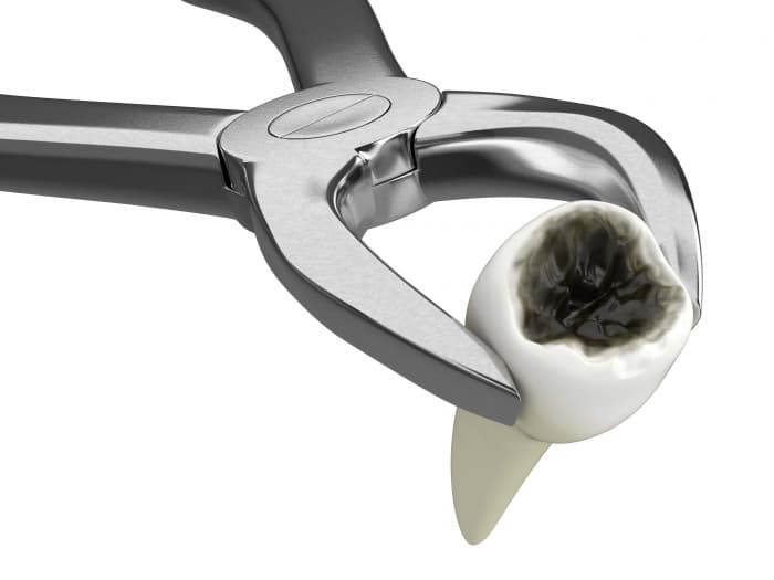 Acute toothache can be serious! Don't delay toothache treatment!