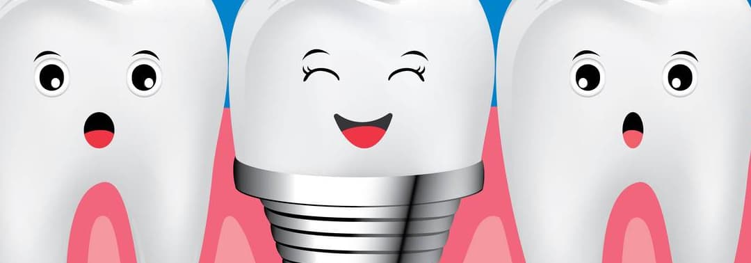 When Is Bone Grafting Needed for Dental Implants in Hong Kong?