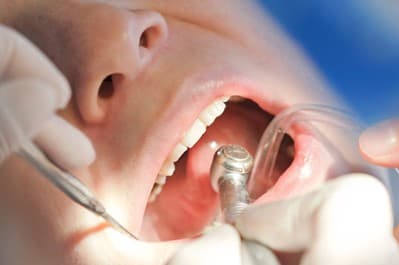 Seeking Immediate Professional Dental Treatment: The Importance of Addressing Acute Toothaches…