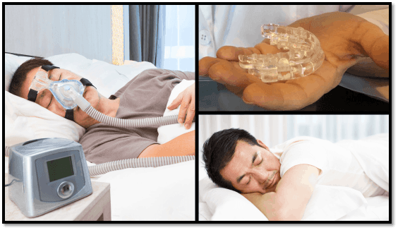 不只有呼吸机!探索改善睡眠窒息症的香港牙科选择