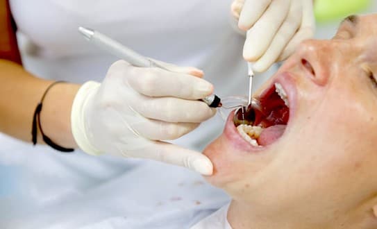 Five Keys to Successful Root Canal Treatment in Hong Kong: Quality of Care and Follow-Up