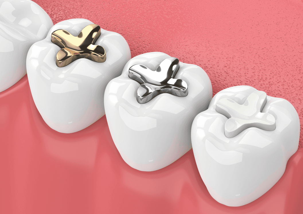 Restorative Dental Services