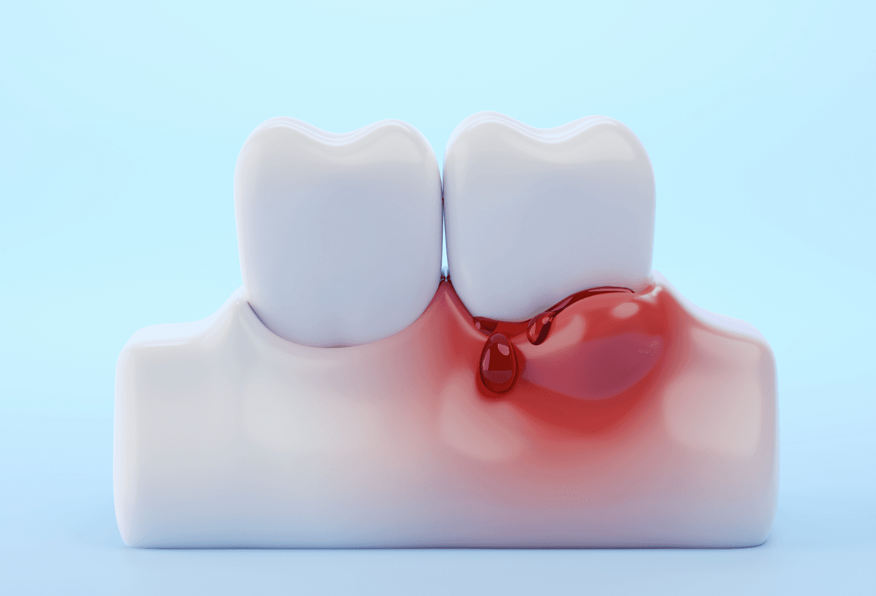 Periodontics