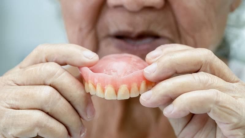 Guide to Premium Dentures and Dental Bridges in Hong Kong