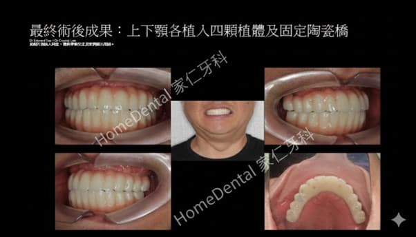 Before & After 成果展示