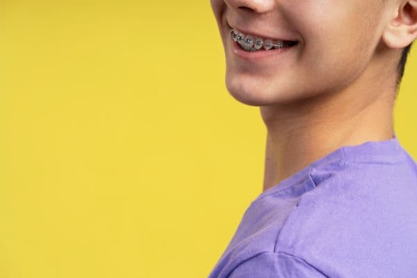 Braces Before and After: Real Changes Beyond Straight Teeth—Bite, Facial Profile, and Common Misconceptions (Hong Kong Guide)